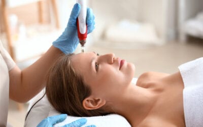Microneedling: What is it and How Does it Work?